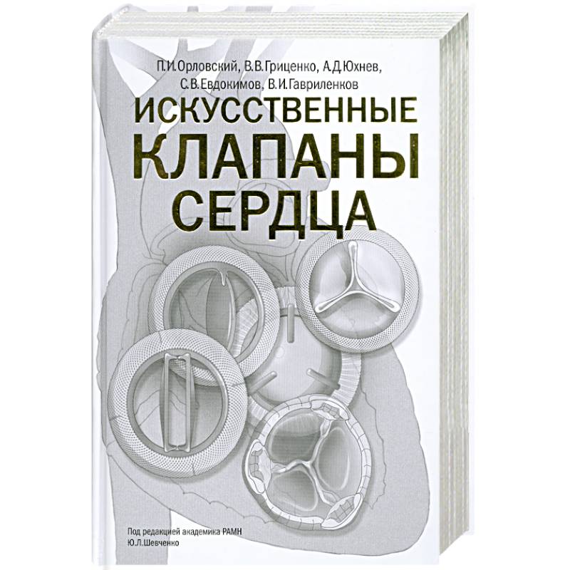 Искусственные клапаны сердца