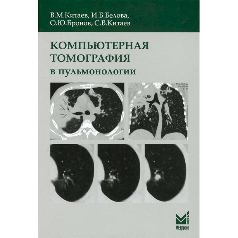 Компьютерная томография в пульмонологии