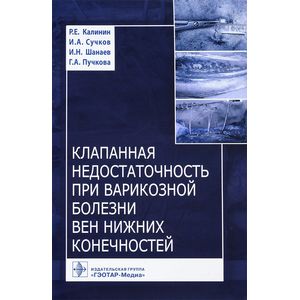Клапанная недостаточность при варикозной болезни вен нижних конечностей