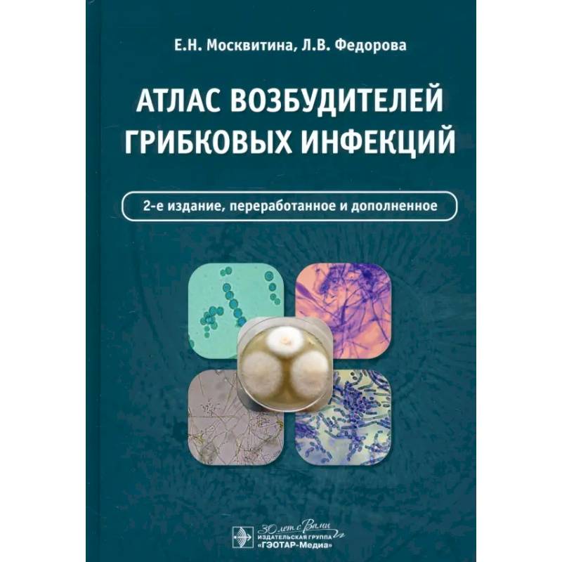 Атлас возбудителей грибковых инфекций