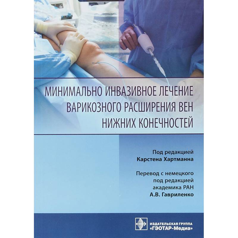 Минимально инвазивных. Варикозное расширение вен нижних конечностей лечение лекарства. Малоинвазивная терапия. Лечение варикозно расширенных вен нижних терапия. Малоинвазивная хирургия книга.