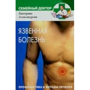 Язвенная болезнь. Профилактика и методы лечения