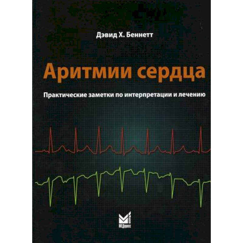 Сердечный практический. Аритмии книга. Аритмии сердца книга. Сердечные аритмии книга. Нарушение ритма сердца книги.