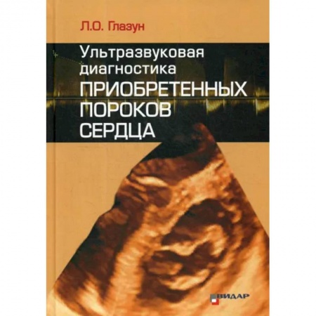 УЗИ. ЭКГ. Томография. Рентген, книга Ультразвуковая диагностика приобретенных пороков сердца заказать