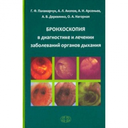 Терапия. Пульмонология, книга Бронхоскопия в диагностике и лечении заболеваний органов дыхания заказать