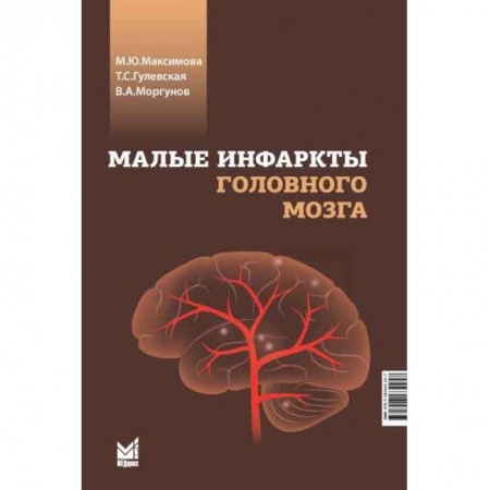 Неврология, книга Малые инфаркты головного мозга заказать