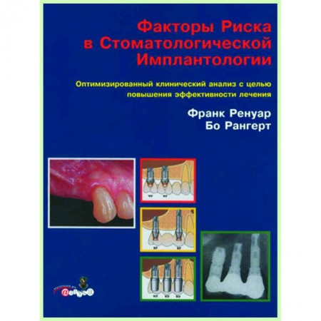 Стоматология, книга Факторы риска в стоматологической имплантологии. заказать