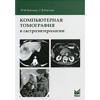 Компьютерная томография в гастроэнтерологии: руководство для врачей.