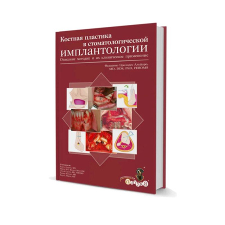 Стоматология, книга Костная пластика в стоматологической имплантологии. Описание методик и их клинического применения заказать