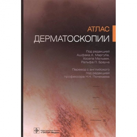 Кожные и венерические болезни, книга Атлас дерматоскопии заказать
