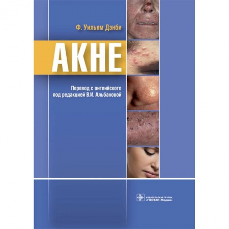 Диагностика и лечение, книга Акне заказать