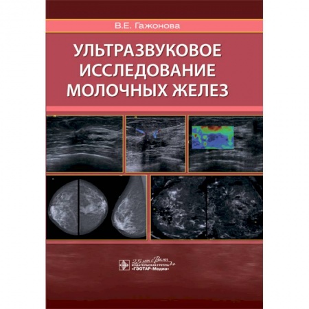 Диагностика и лечение, книга Ультразвуковое исследование молочных желез заказать