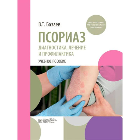 Медицинские энциклопедии и справочники, книга Псориаз. Диагностика, лечение и профилактика : учебное пособие заказать