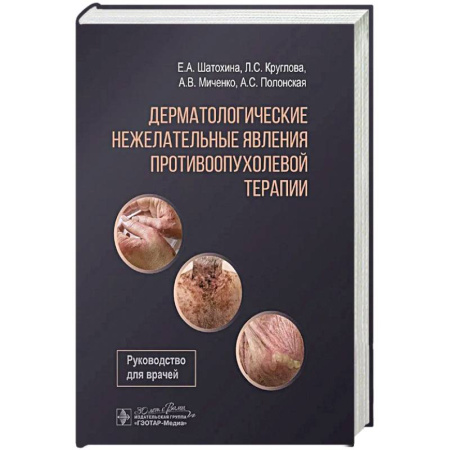 Другие терапии, книга Дерматологические явления противоопухолевой терапии заказать