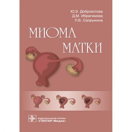 Медицинские энциклопедии и справочники, книга Миома матки заказать