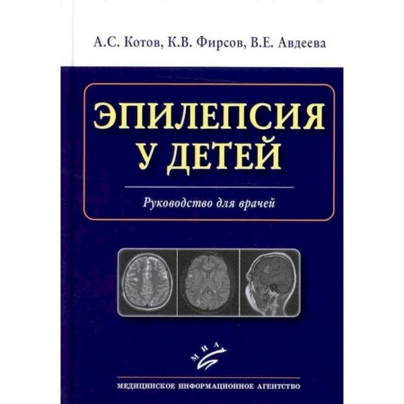 Неврология, книга Эпилепсия у детей. Руководство для врачей заказать