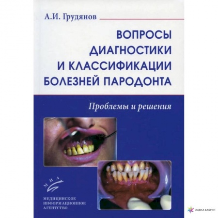 Стоматология, книга Вопросы диагностики и классификации болезней пародонта. Проблемы и решения заказать