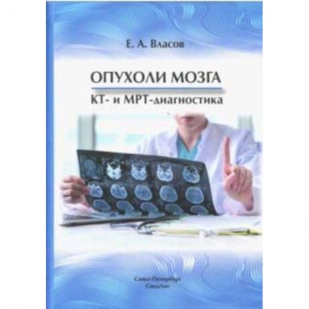 Онкология, книга Опухоли мозга  КТ- и МРТ- диагностика заказать