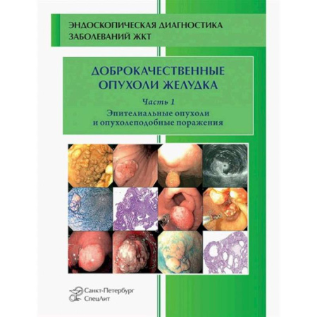 Онкология, книга Доброкачественные опухоли желудка. Часть1: Эпителиальные опухоли и опухолеподобные поражения: Учебно-методическое пособие заказать