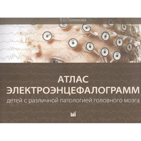 Неврология, книга Атлас электроэнцефалограмм детей с различной патологией головного мозга заказать