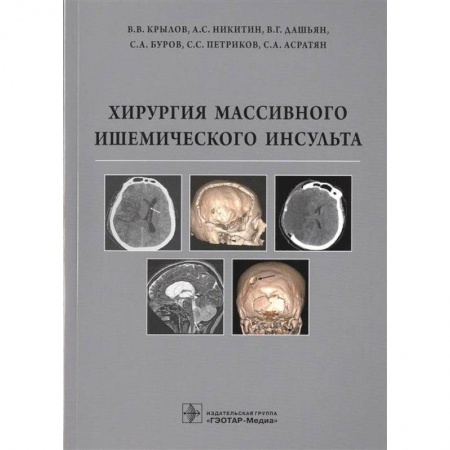 Хирургия. Ортопедия, книга Хирургия массивного ишемического инсульта заказать