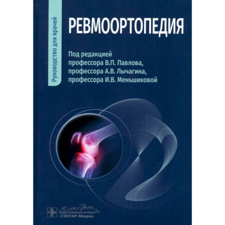 Хирургия. Ортопедия, книга Ревмоортопедия. Руководство для врачей заказать