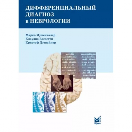 Неврология, книга Дифференциальный диагноз в неврологии. Руководство по оценке, классификации и дифференциональной диагностике неврологических симптомов заказать