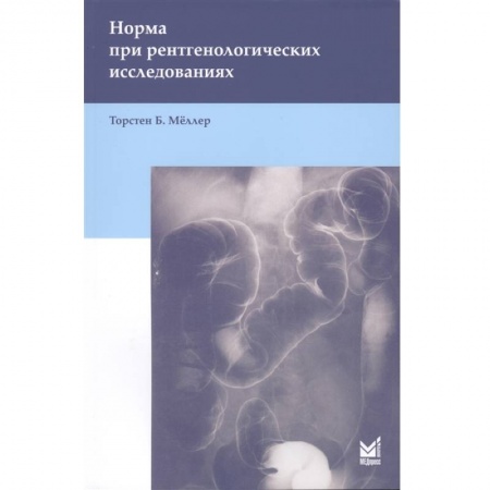 Фармакология. Рецептура. Токсикология, книга Норма при рентгенологических исследованиях . Мёллер Т.Б. заказать