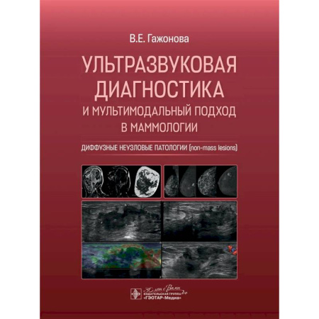 Медицинские энциклопедии и справочники, книга Ультразвуковая диагностика и мультимодальный подход в маммологии. Диффузные неузловые патологии заказать
