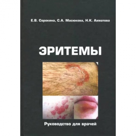Кожные и венерические болезни, книга Эритемы. Руководство для врачей заказать