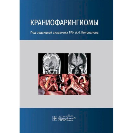 Онкология, книга Краниофарингиомы заказать