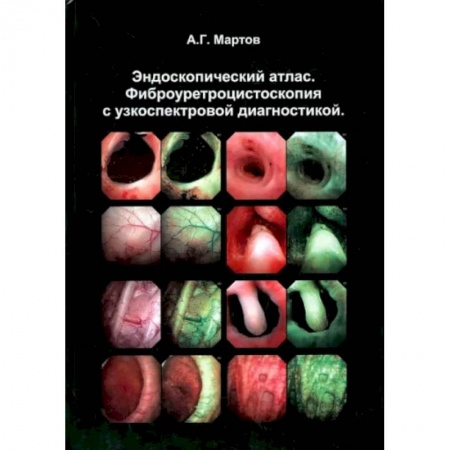 Урология, книга Эндоскопический атлас. Фиброуретроцистоскопия с узкоспектровой диагностикой заказать