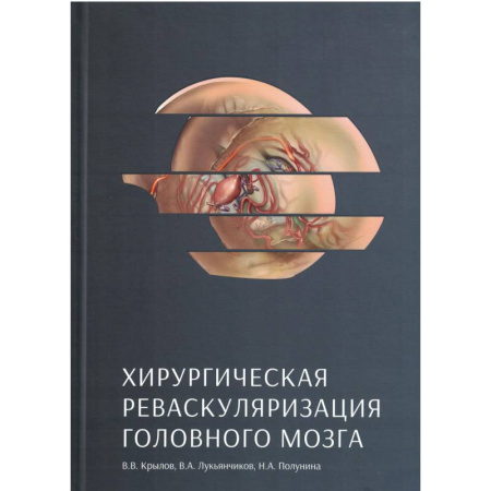 Медицинские энциклопедии и справочники, книга Хирургическая реваскуляризация головного мозга заказать