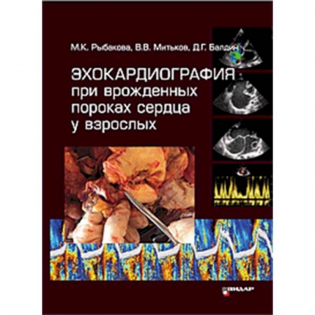 Кардиология, книга Эхокардиография при врожденных пороках сердца у взрослых заказать