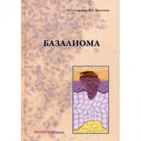 Онкология, книга Базалиома заказать