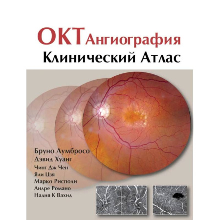 ЛОР. Оториноларингология, книга ОКТ-ангиография. Клинический атлас заказать