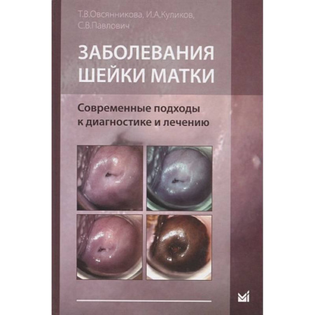 Онкология, книга Заболевания шейки матки. Современные подходы к диагностике и лечению заказать