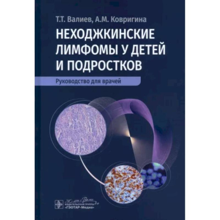 Педиатрия, книга Неходжкинские лимфомы у детей и подростков заказать
