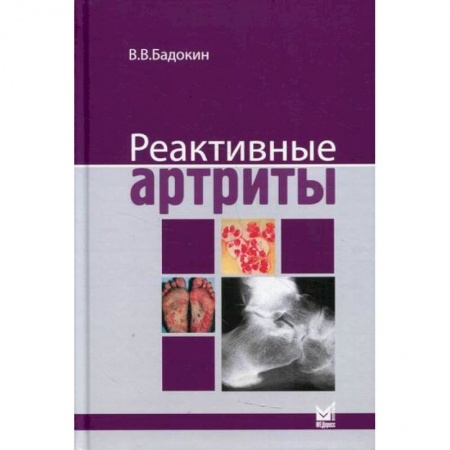 Другие виды специальной медицины, книга Реактивные артриты. Урогенитальные и постэнтероколитические заказать