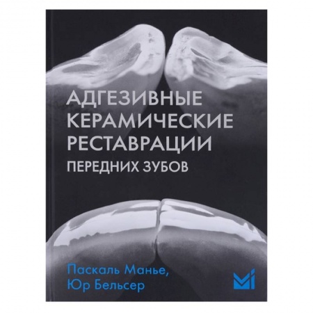 Стоматология, книга Адгезивные керамические реставрации передних зубов заказать
