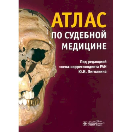 Криминал, книга Атлас по судебной медицине заказать
