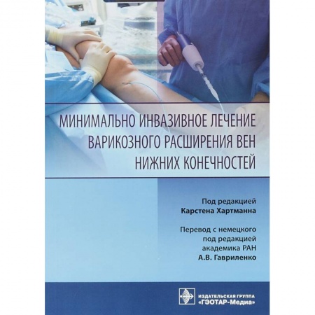 Хирургия. Ортопедия, книга Минимально инвазивное лечение варикозного расширения вен заказать