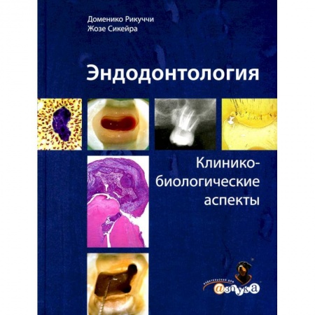 Стоматология, книга Эндодонтология. Клинико-биологические аспекты заказать
