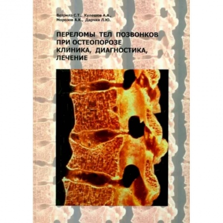 Хирургия. Ортопедия, книга Переломы тел позвонков при остеопорозе. Клиника, диагностика, лечение заказать