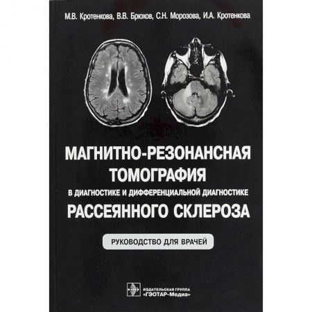 Неврология, книга Магнитно-резонансная томография в диагностике и дифференциальной диагностике рассеянного склероза заказать