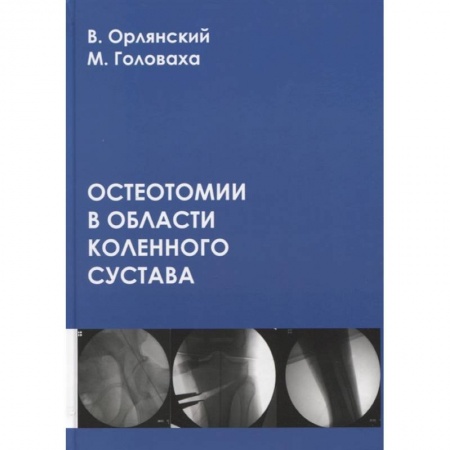 Хирургия. Ортопедия, книга Остеотомии в области коленного сустава заказать