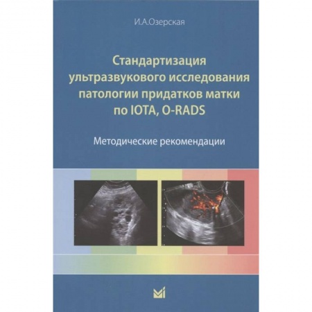Патологическая анатомия и физиология. Иммунопатология, книга Стандартизация ультразвукового исследования патологии придатков матки по IOTA, O-RADS. Методические рекомендации заказать