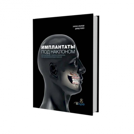 Стоматология, книга Имплантаты под наклоном. Протезирование с опорой на имплантаты при выраженной атрофии челюстей заказать