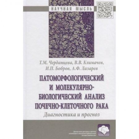 Онкология, книга Патоморфологический и молекулярно-биологический анализ почечно-клеточного рака. Диагностика и прогноз. Монография заказать