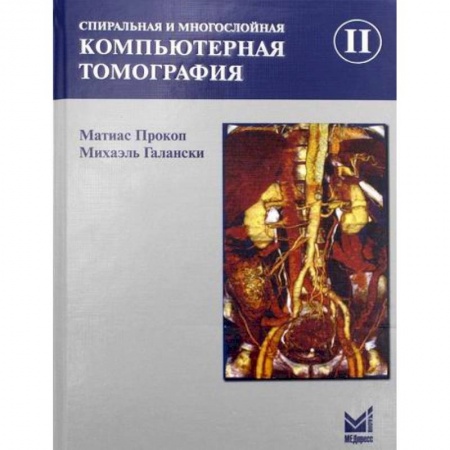 УЗИ. ЭКГ. Томография. Рентген, книга Спиральная и многослойная компьютерная томография заказать